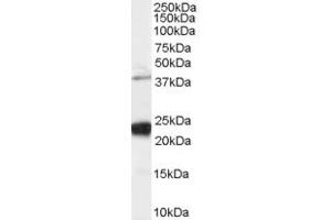 Western Blotting (WB) image for anti-GIPC PDZ Domain Containing Family, Member 1 (GIPC1) (C-Term) antibody (ABIN2465223) (GIPC1 anticorps  (C-Term))