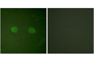 Immunofluorescence analysis of HeLa cells, using PPAR-alpha (Ab-21) Antibody. (PPARA anticorps  (AA 6-55))
