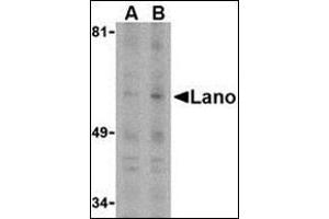Western blot analysis of Lano in PC-3 whole cell lysate with this product at (A) 1 or (B) 2 μg /ml. (LRRC1 anticorps  (C-Term))