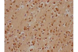 IHC image of ABIN7146598 diluted at 1:200 and staining in paraffin-embedded human brain tissue performed on a Leica BondTM system. (PRKACA anticorps  (Catalytic Subunit alpha))
