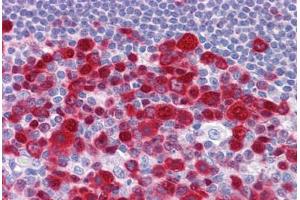 Human Tonsil: Formalin-Fixed, Paraffin-Embedded (FFPE) (Deoxyuridine Triphosphatase (DUT) (AA 68-164) anticorps)