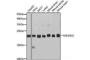 Western blot analysis of extracts of various cell lines using NDUFB10 Polyclonal Antibody at dilution of 1:1000. (NDUFB10 anticorps)