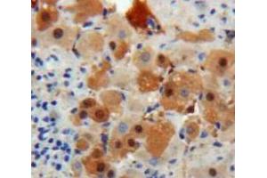 IHC-P analysis of Liver tissue, with DAB staining. (TTR anticorps  (AA 21-147))