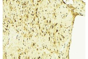 ABIN6275689 at 1/100 staining Mouse muscle tissue by IHC-P. (ZFYVE19 anticorps  (Internal Region))