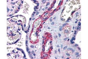 Immunohistochemistry (IHC) image for anti-SUZ12 Polycomb Repressive Complex 2 Subunit (SUZ12) (Middle Region) antibody (ABIN2779689)