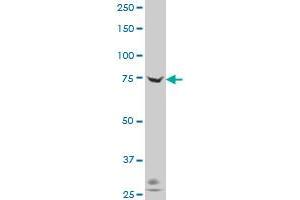 ADAM20 polyclonal antibody (A01), Lot # 060613JCS1 Western Blot analysis of ADAM20 expression in Hela S3 NE . (ADAM20 anticorps  (AA 268-358))