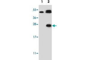 Western blot analysis of KLK6 (arrow) using KLK6 polyclonal antibody . (Kallikrein 6 anticorps  (Internal Region))