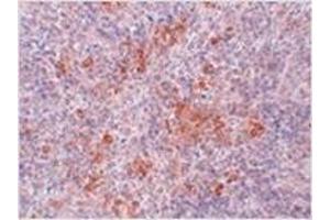 Immunohistochemistry of AGTR1 in mouse kidney tissue with AGTR1 antibody at 2.