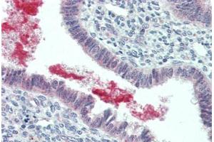 Human Uterus (formalin-fixed, paraffin-embedded) stained with GRN antibody ABIN396952 at 5 ug/ml followed by biotinylated goat anti-rabbit IgG secondary antibody ABIN481713, alkaline phosphatase-streptavidin and chromogen.