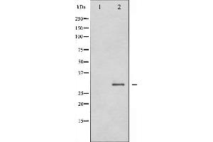 Western blot analysis of SNAI1 expression in HT29 whole cell lysates,The lane on the left is treated with the antigen-specific peptide. (SNAIL anticorps  (C-Term))