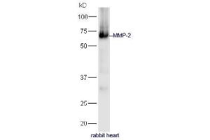 Rabbit heart lysates probed with Anti-MMP-2 Polyclonal Antibody, Unconjugated (ABIN707426) at 1:300 in 4˚C. (MMP2 anticorps  (AA 401-500))