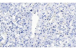 ABIN570915 Negative Control showing staining of paraffin embedded Human Adrenal Gland, with no primary antibody.