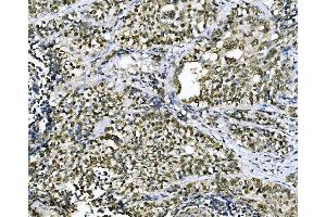 IHC analysis of CSNK2B using anti-CSNK2B antibody (ABIN7599092). (CSNK2B anticorps  (AA 1-215))