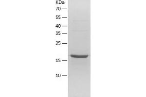 Western Blotting (WB) image for Cyclin-Dependent Kinase 5, Regulatory Subunit 1 (p35) (CDK5R1) (AA 1-160) protein (His tag) (ABIN7122534) (CDK5R1 Protein (AA 1-160) (His tag))