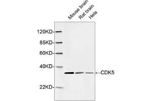 Western blot analysis of cell and tissue lysates using 1 µg/mL Rabbit Anti-CDK5 Polyclonal Antibody (ABIN398921) The signal was developed with IRDyeTM 800 Conjugated Goat Anti-Rabbit IgG. (CDK5 anticorps  (C-Term))