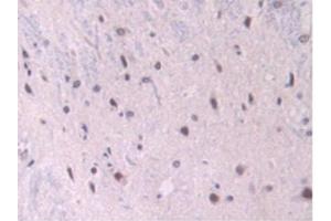 IHC-P analysis of Rat Spinal Cord Tissue, with DAB staining. (Endoglin anticorps  (AA 26-136))