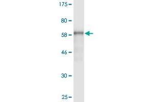 Western Blot detection against Immunogen (62. (AMBP anticorps  (AA 19-352))
