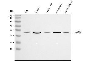 Western blot analysis of RBMY1A1 using anti-RBMY1A1 antibody (ABIN7600392).