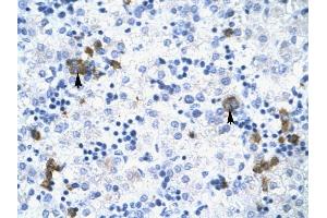 TRIM17 antibody was used for immunohistochemistry at a concentration of 4-8 ug/ml to stain Liver cells (arrows) in Human Liver. (TRIM17 / RNF16 anticorps  (Middle Region))