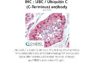 Image no. 2 for anti-Ubiquitin C (UBC) (C-Term) antibody (ABIN2852400) (UBC anticorps  (C-Term))