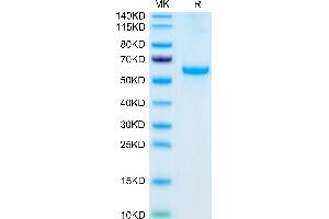 Human Adiponectin on Tris-Bis PAGE under reduced condition. (ADIPOQ Protein (AA 19-244) (Fc Tag))