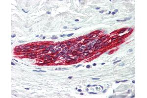 anti-Death-Associated Protein Kinase 2 (DAPK2) (C-Term) antibody