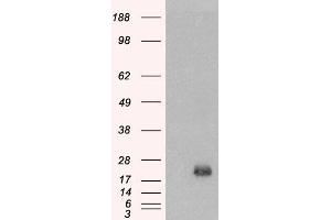 Western Blotting (WB) image for anti-Brain and Acute Leukemia, Cytoplasmic (BAALC) antibody (ABIN5858423) (BAALC anticorps)