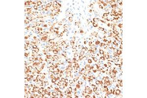 Immunohistochemistry of paraffin-embedded rat ovary using KLHL9 antibody (ABIN6132083, ABIN6142940, ABIN6142941 and ABIN6214299) at dilution of 1:100 (40x lens). (KLHL9 anticorps  (AA 1-100))