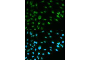 Immunofluorescence analysis of HeLa cell using MCM7 antibody.
