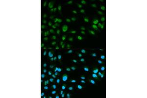 Immunofluorescence analysis of HeLa cell using MCM7 antibody. (MCM7 anticorps  (AA 360-719))
