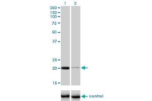 Western blot analysis of CETN3 over-expressed 293 cell line, cotransfected with CETN3 Validated Chimera RNAi (Lane 2) or non-transfected control (Lane 1).