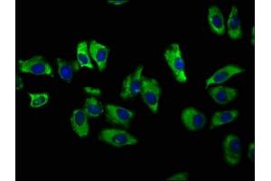 Immunofluorescence staining of A549 cells with ABIN7170071 at 1:100, counter-stained with DAPI.