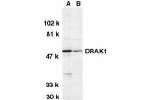 Western blot analysis of DRAK1 in (A) MOLT4 and (B) A431 whole cell lysates with DRAK1 antibody at 1μg/ml. (STK17A anticorps  (AA 5-19))