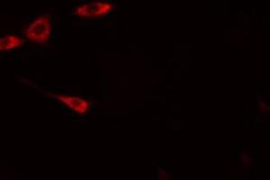 anti-ADP-Ribosylation Factor GTPase Activating Protein 1 (ARFGAP1) (Internal Region) antibody