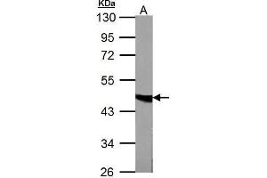 WB Image Fumarate hydratase antibody detects FH protein by Western blot analysis.
