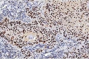 IHC analysis of FEN1 using anti-FEN1 antibody (ABIN7601618). (FEN1 anticorps  (AA 4-300))