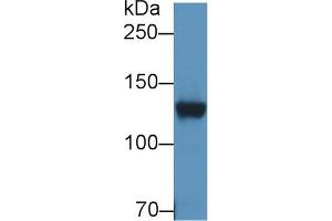 Detection of DPP6 in Rat Cerebrum lysate using Polyclonal Antibody to Dipeptidyl Peptidase 6 (DPP6) (DPP6 anticorps  (AA 667-865))