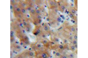 Used in DAB staining on fromalin fixed paraffin-embedded Liver tissue (IGF1 anticorps  (AA 49-153))