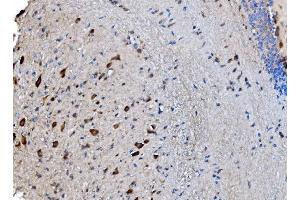 IHC analysis of GABARAP using anti-GABARAP antibody (ABIN7603159). (GABARAP anticorps  (N-Term))