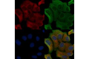 ABIN6258012 and ABIN6275850 staining Hela cells by IF/ICC.