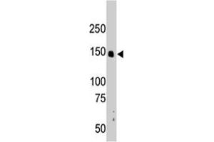 The CRKRS polyclonal antibody  is used in Western blot to detect CRKRS in mouse liver tissue lysate. (CDK12 anticorps  (N-Term))