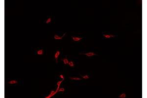 ABIN6275090 staining Hela by IF/ICC. (PJA2 anticorps)