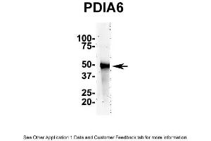 IP Suggested AntiPDIA6 Antibody Positive Control: NT2 CELL/BRAIN TISSUE (PDIA6 anticorps  (N-Term))