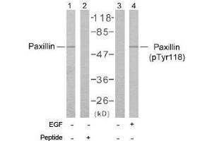 Image no. 2 for anti-Paxillin (PXN) (Tyr118) antibody (ABIN197279) (Paxillin anticorps  (Tyr118))