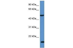 Western Blot showing INPP5K antibody used at a concentration of 1 ug/ml against Fetal Liver Lysate (INPP5K anticorps  (C-Term))
