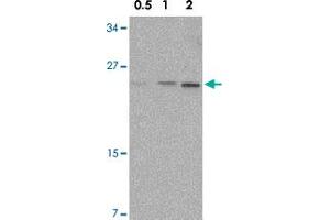 Western blot analysis of NKIRAS1 in Raw 264. (NKIRAS1 anticorps  (C-Term))