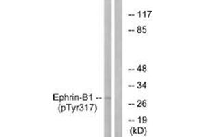 Western blot analysis of extracts from mouse brain, using EFNB1 (Phospho-Tyr317) Antibody. (Ephrin B1 anticorps  (pTyr317))