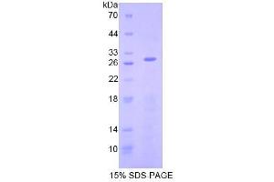 SDS-PAGE analysis of Human AIF Protein.