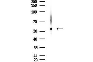 Western blot analysis of lysates from Mouse lung, using Src Antibody at 1/1000 dilution.