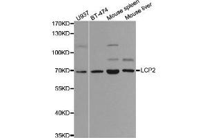 Western blot analysis of extracts of various cell lines, using LCP2 antibody. (LCP2 anticorps  (AA 284-533))